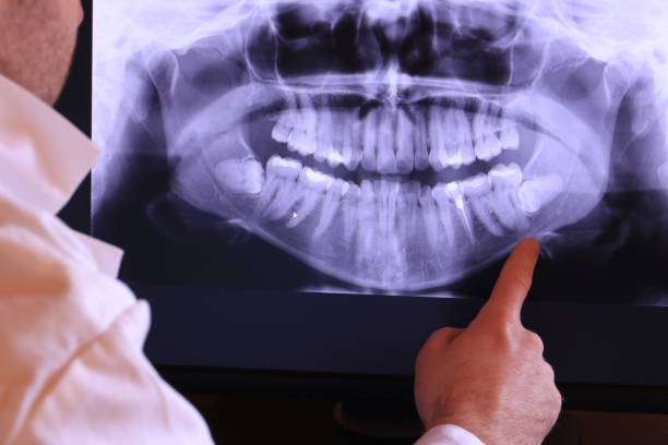 Best Emergency Dental Extractions in Lake Panasoffkee, FL